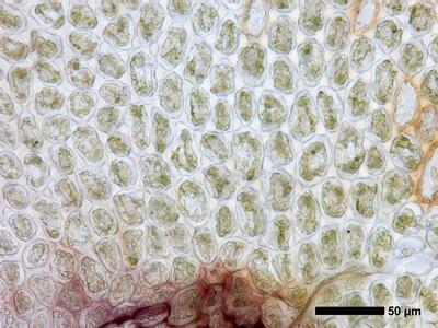 lophozia longiflora 1 flankenblatt blattbasis