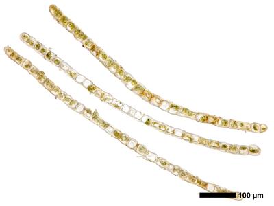 lophozia longiflora 1 flankenblatt quer