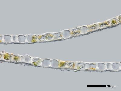 lophozia longiflora 1 flankenblatt quer detail
