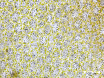 lophozia longiflora flankenblatt blattmitte