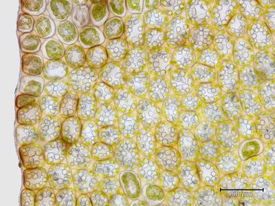 lophozia longiflora flankenblatt blattrand