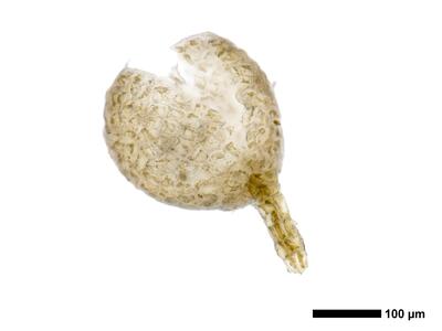 lophozia opacifolia antheridium