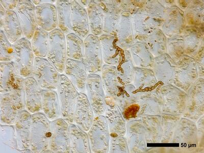 lophozia opacifolia flankenblatt blattbasis