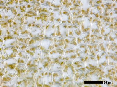 lophozia opacifolia flankenblatt blattmitte