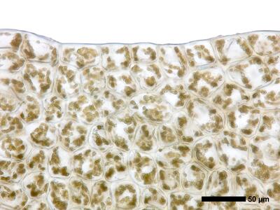 lophozia opacifolia flankenblatt blattrand