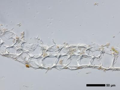 lophozia opacifolia flankenblatt quer detail1