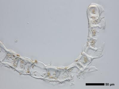 lophozia opacifolia flankenblatt quer detail2