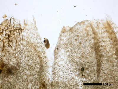 lophozia opacifolia perianthmuendung