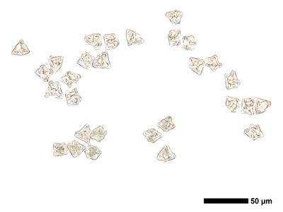 lophozia silvicola 1 brutgemmen