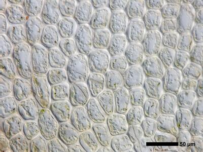 lophozia silvicola 1 flankenblatt blattbasis