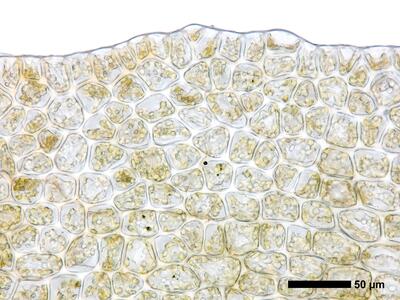 lophozia silvicola 1 flankenblatt blattrand