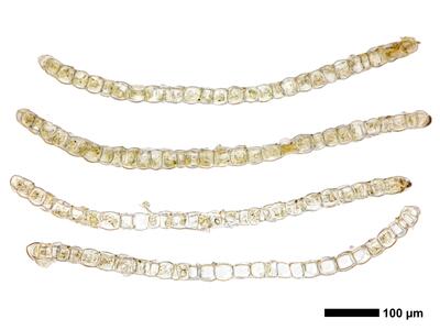 lophozia silvicola 1 flankenblatt quer