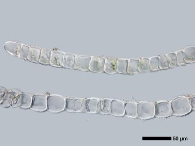 lophozia silvicola 1 flankenblatt quer detail