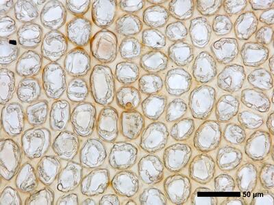 lophozia ventricosa flankenblatt blattmitte