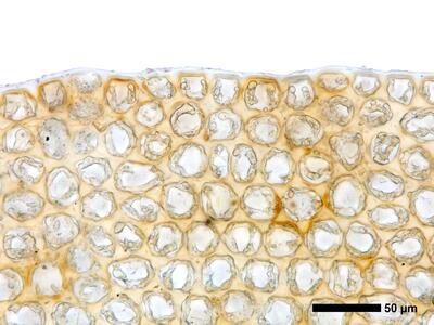 lophozia ventricosa flankenblatt blattrand