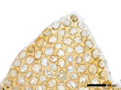 lophozia ventricosa flankenblatt blattspitze
