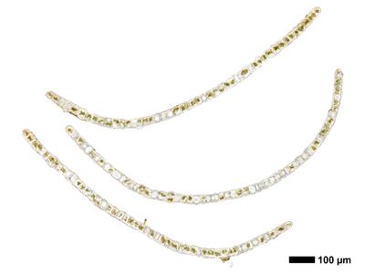 lophozia ventricosa flankenblatt quer
