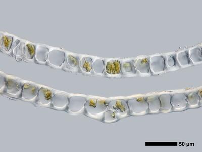lophozia ventricosa flankenblatt quer detail