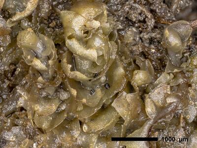 lophozia wenzelii 1 archegonien