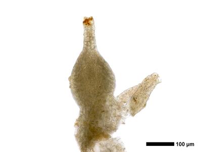 lophozia wenzelii 1 archegonium