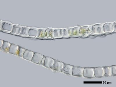 lophozia wenzelii 1 flankenblatt quer detail