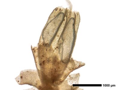 lophozia wenzelii 1 habitus oberseite perianth2