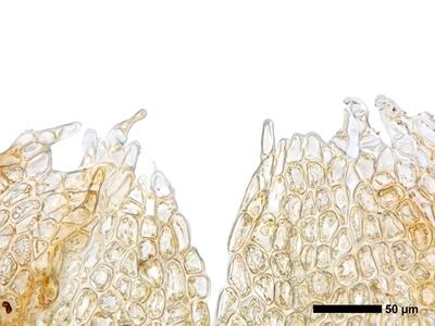 lophozia wenzelii 1 perianthmuendung detail
