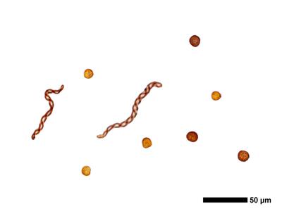 lophozia wenzelii 1 sporen elateren