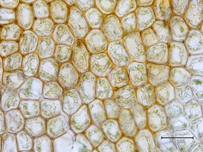 schistochilopsis hyperarctica flankenblatt blattmitte