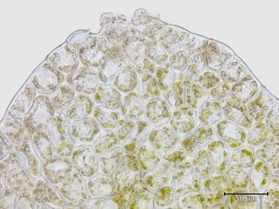 schistochilopsis hyperarctica flankenblatt blattspitze