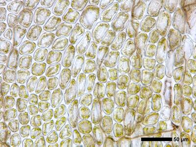 tritomaria exsecta 1 flankenblatt blattmitte
