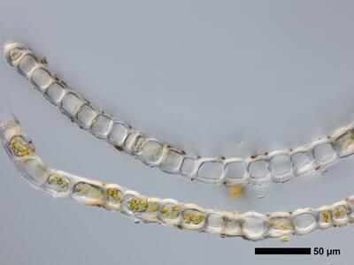tritomaria exsecta 1 flankenblatt quer detail