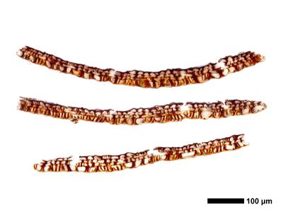 tritomaria exsectiformis 1 kapsel quer