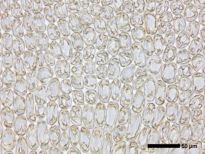 tritomaria exsectiformis 2 flankenblatt blattmitte