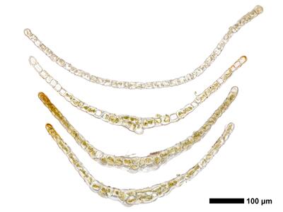 tritomaria exsectiformis 2 flankenblatt quer