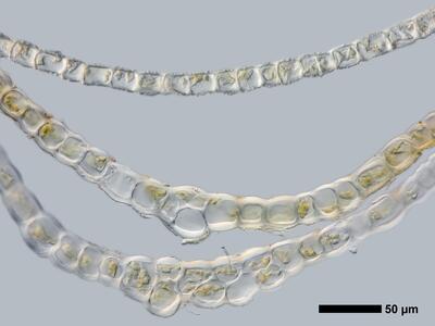 tritomaria exsectiformis 2 flankenblatt quer detail