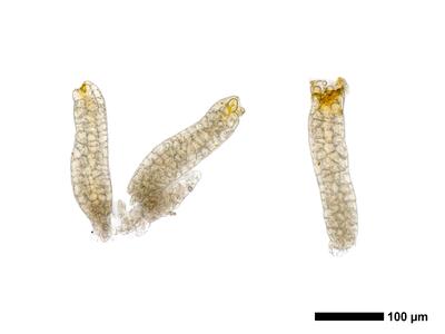 tritomaria polita 1 archegonien