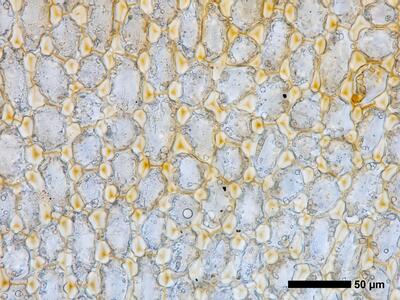 tritomaria polita 1 flankenblatt blattmitte