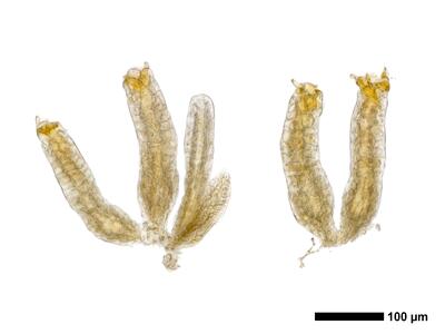 tritomaria quinquedentata 1 archegonien