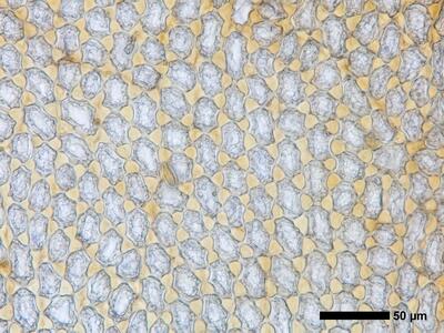 tritomaria quinquedentata 1 flankenblatt blattmitte