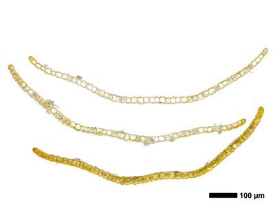 tritomaria scitula 1 flankenblatt quer