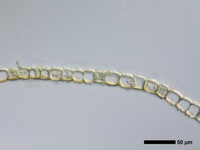 tritomaria scitula 1 flankenblatt quer detail