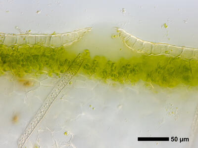 lunularia cruciata air pore cross section
