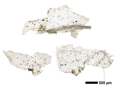 lunularia cruciata ventral scales