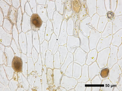 lunularia cruciata ventral scales detail