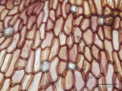 marchantia paleacea rhizodermis aufsicht