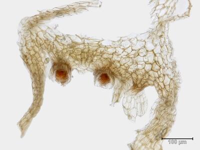 marchantia polymorpha ssp montivagans archegonien quer