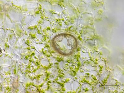 marchantia polymorpha ssp montivagans atempore aufsicht