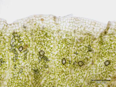 marchantia polymorpha ssp montivagans thallusrand aufsicht
