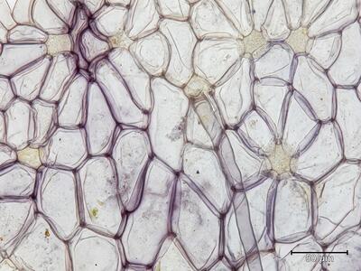 marchantia polymorpha ssp polymorpha rhizodermis